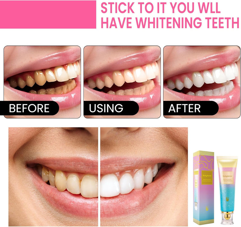 Niacinamide Intensive Whitening Toothpaste - Stain Removal & Fresh Breath