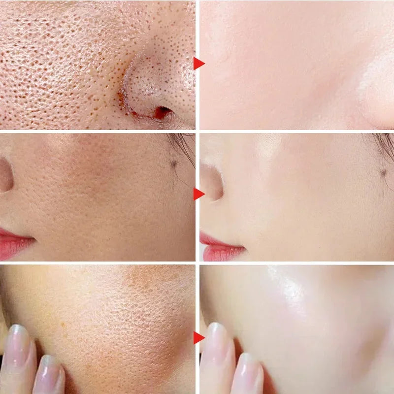 Facial Redness Repair Serum Improve Sensitive Skin Dryness Moisturizer Hydrating Sooth Lotion Removal Rosacea Korean Cosmetics