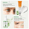 JoyPretty Acne Treatment Face Cream Tea Tree Serum Cleaning Pimple Acne Removal Repair Pores Korean Cosmetics Skin Care Kit 6pcs
