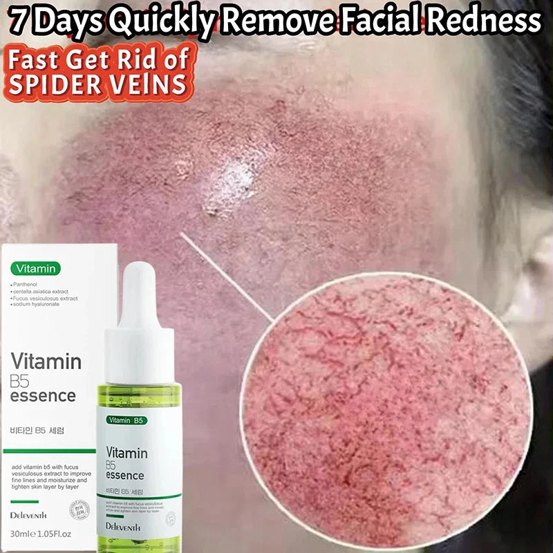 Facial Redness Repair Serum Improve Sensitive Skin Dryness Moisturizer Hydrating Sooth Lotion Removal Rosacea Korean Cosmetics