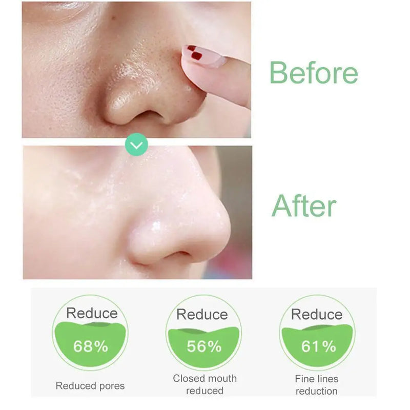 Salicylic Acid Pore Shrinking Essence Anti-acne Exfoliating Blackhead Remover Face Spot Removal Essence Beauty Health Skin Care