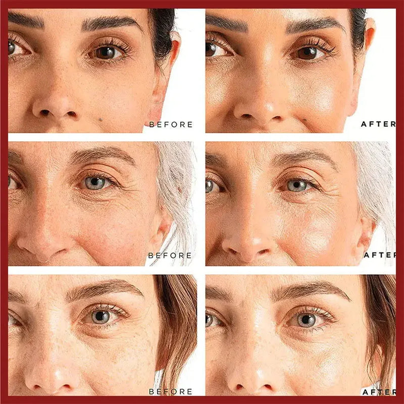 Retinol Wrinkle Remover Face Cream Firming Lifting Anti Aging Fade Fine Lines Moisturizing Whitening Skin Care Korean Cosmetics