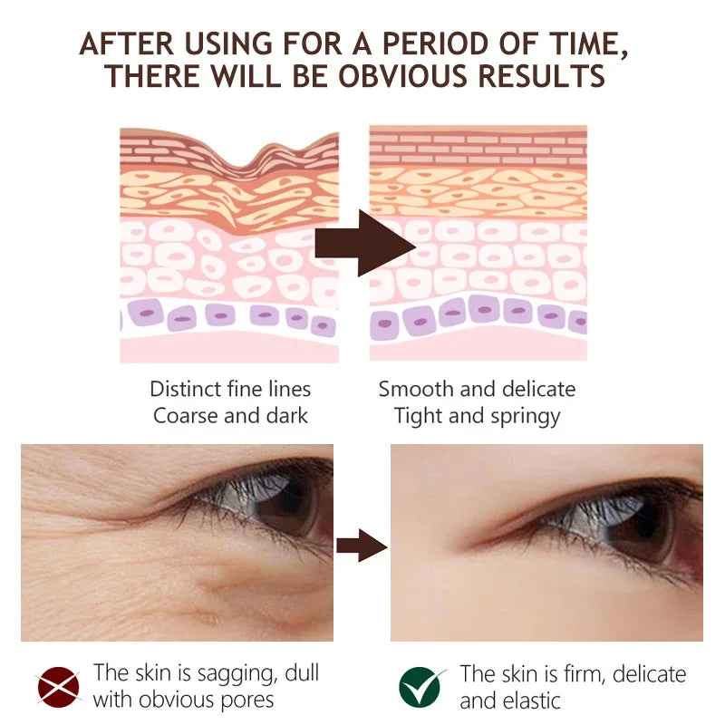 Retinol Face Cream Anti-Aging Wrinkle Remover Firming Lifting Skin Care Fade Fine Lines Whitening Moisturizing Korean Cosmetics
